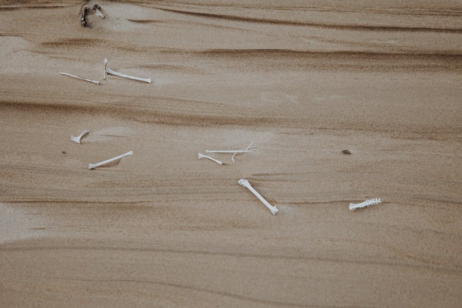 Terapia igłowa Warszawa: Skuteczne leczenie bólu i stresu Acupuncture needles